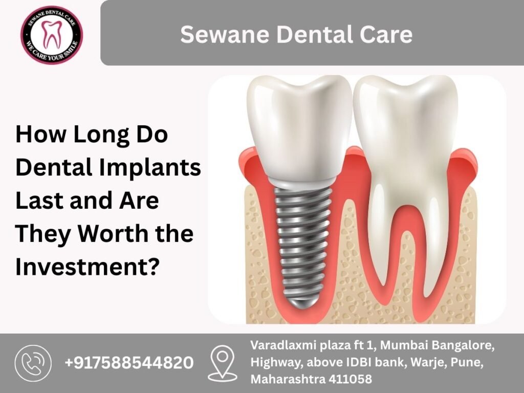How Long Do Dental Implants Last and Are They Worth the Investment?