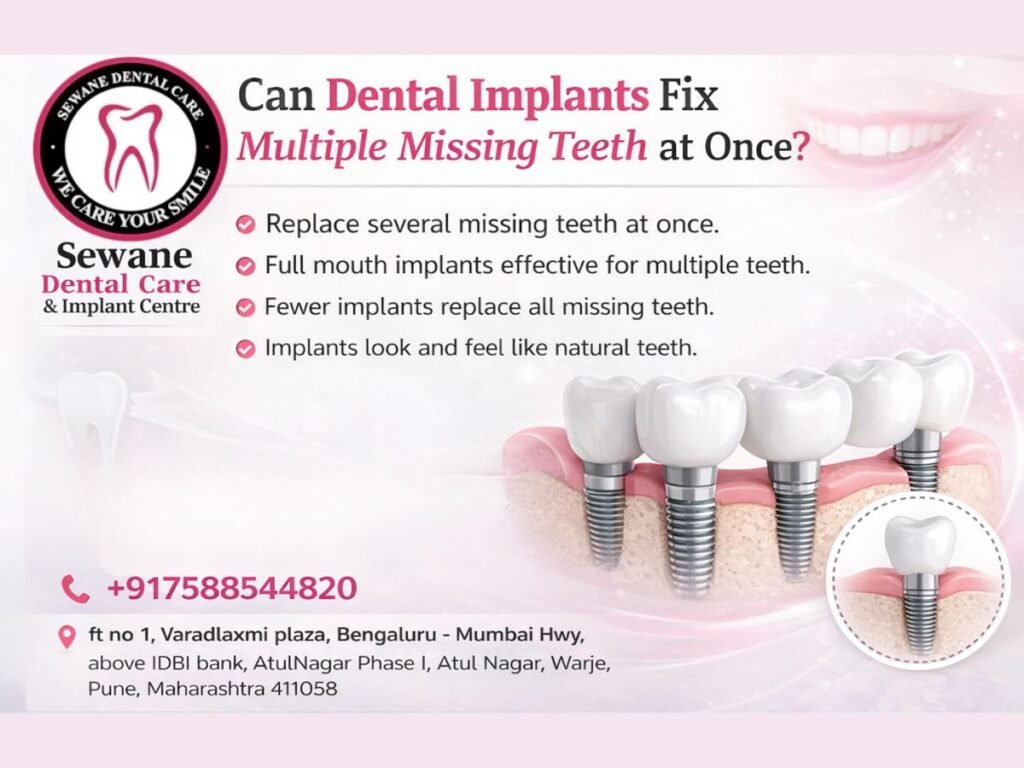 Dental Implant in Warje, RCT in Warje, RE-RCT in Warje, Full Mouth Implant in Warje, Dentist in Warje, Dental Clinic in Warje,