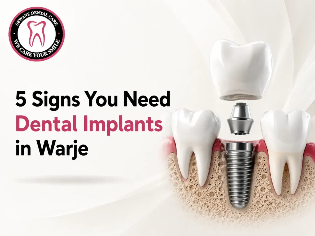 Dental Implants in Warje